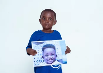 Graft Foundation to offer free reconstructive surgeries in Ashanti Region