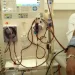 Renal Patients call for help amidst GH¢491 increase cost of dialysis